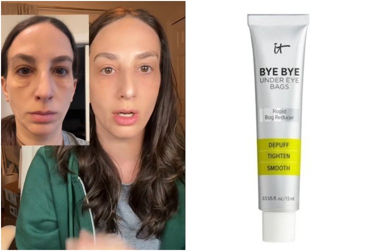 Bye Bye Under Eye Bags: la crema contro le occhiaie